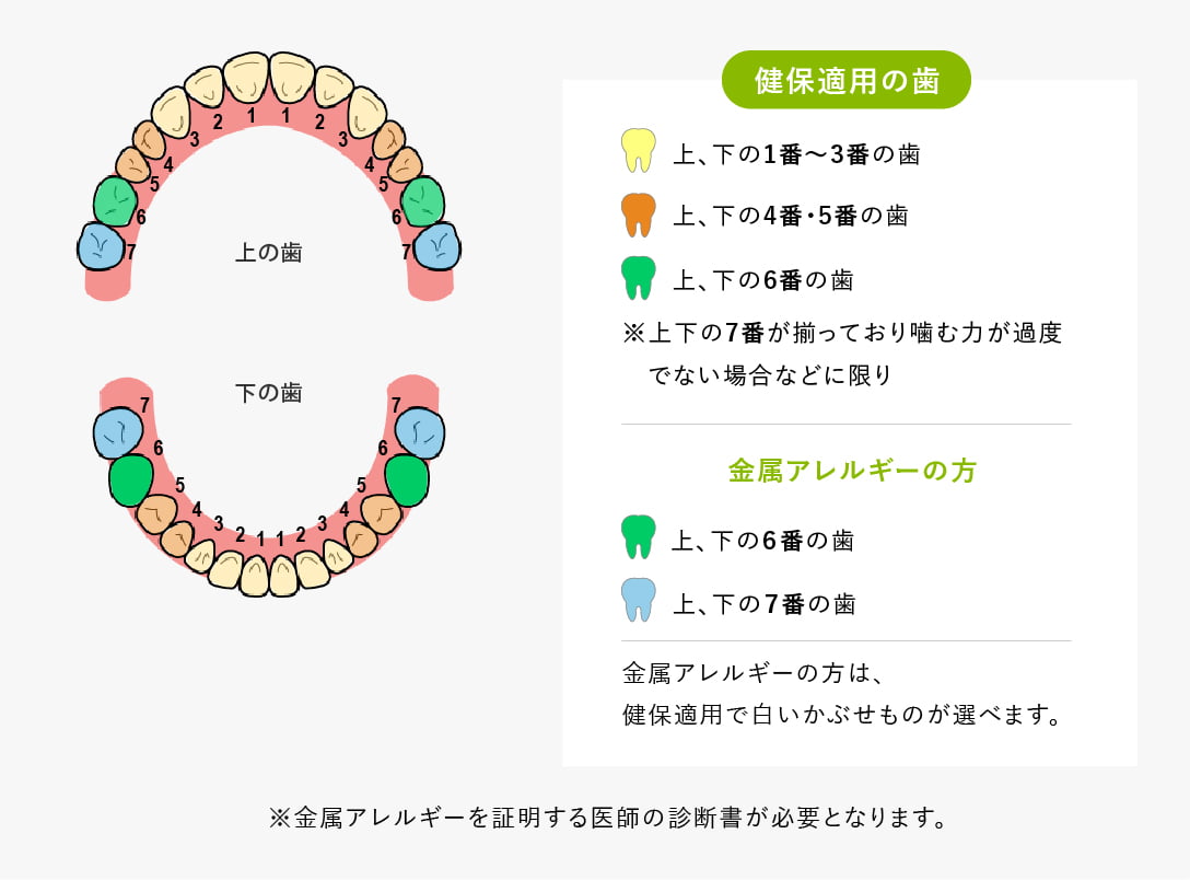 金属アレルギーの方への保険適用について