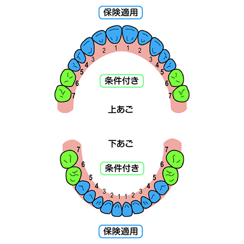 保険適用される部位